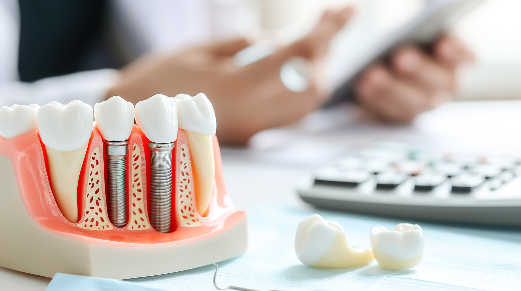 宇都宮市のインプラント専門医江俣歯科医院の3月ブログ記事1